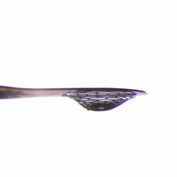 Microbasket Alt View 2